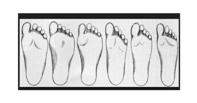 Diferentes tipos de pie