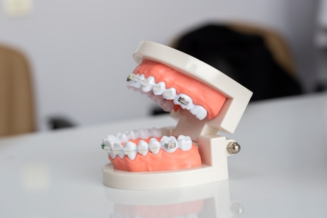 Brackets invisibles vs. tradicionales: �Cu�l es la mejor opci�n para ti?